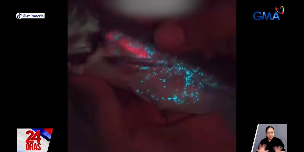 A Woman in Cavite Bought Galunggong That Glows in the Dark — Here's Why Scientists Say It's (Probably) Not Dangerous