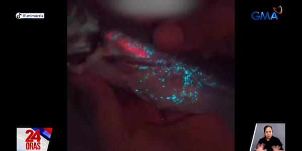 A Woman in Cavite Bought Galunggong That Glows in the Dark — Here's Why Scientists Say It's (Probably) Not Dangerous